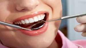 Dental Exam